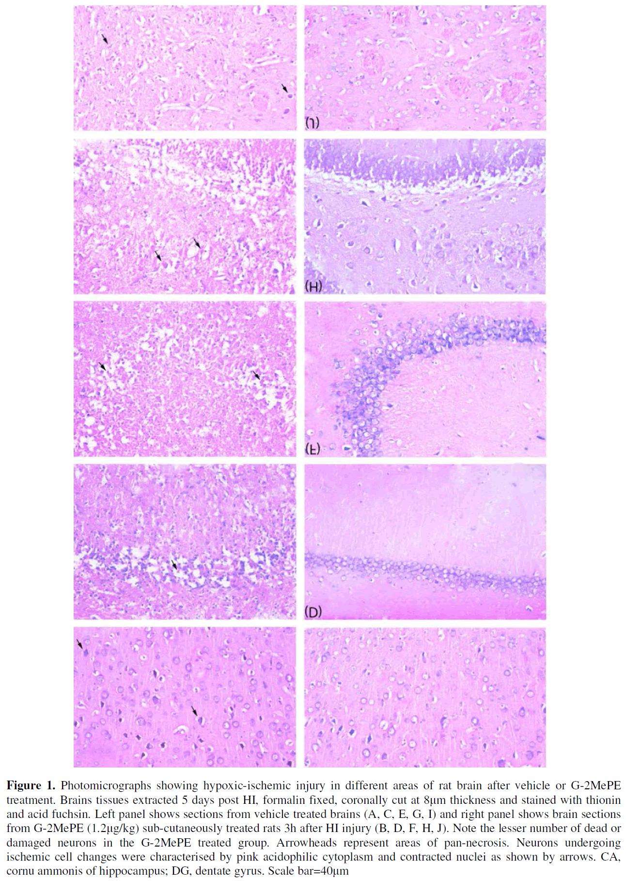 experimental-stroke-translational-medicine-Photomicrographs