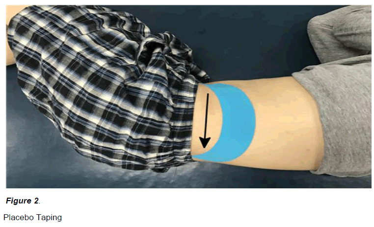 experimental-stroke-translational-medicine-Placebo-Taping