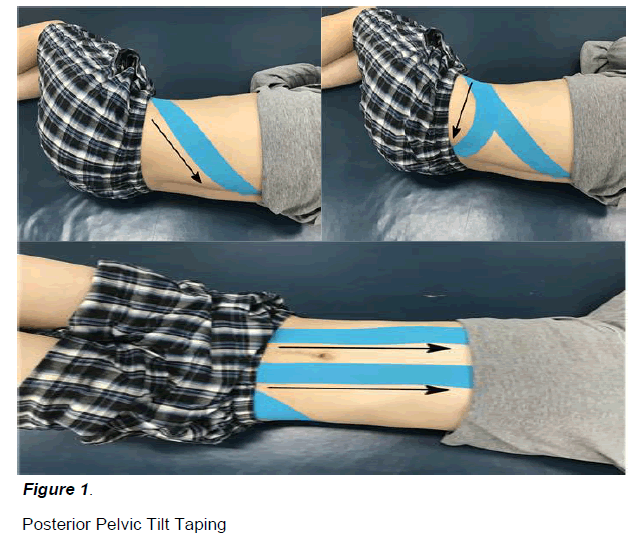 experimental-stroke-translational-medicine-Posterior-Pelvic