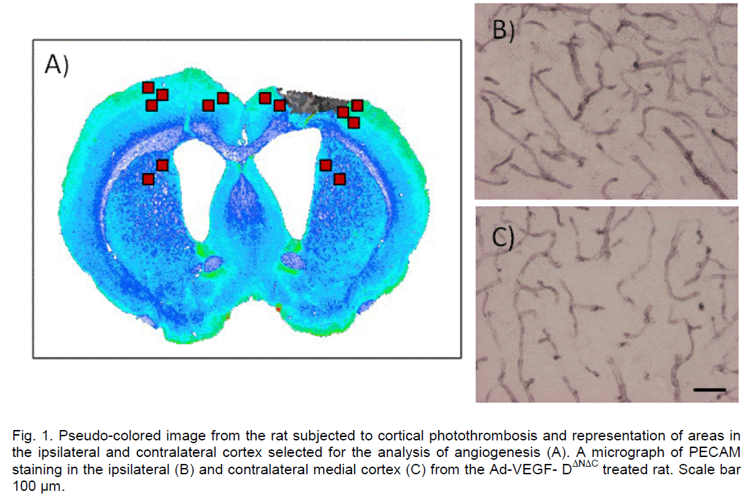 experimental-stroke-translational-medicine-Pseudo-colored