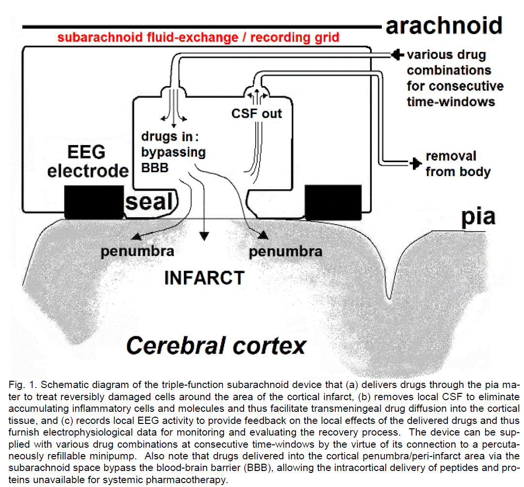 experimental-stroke-translational-medicine-Schematic-diagram