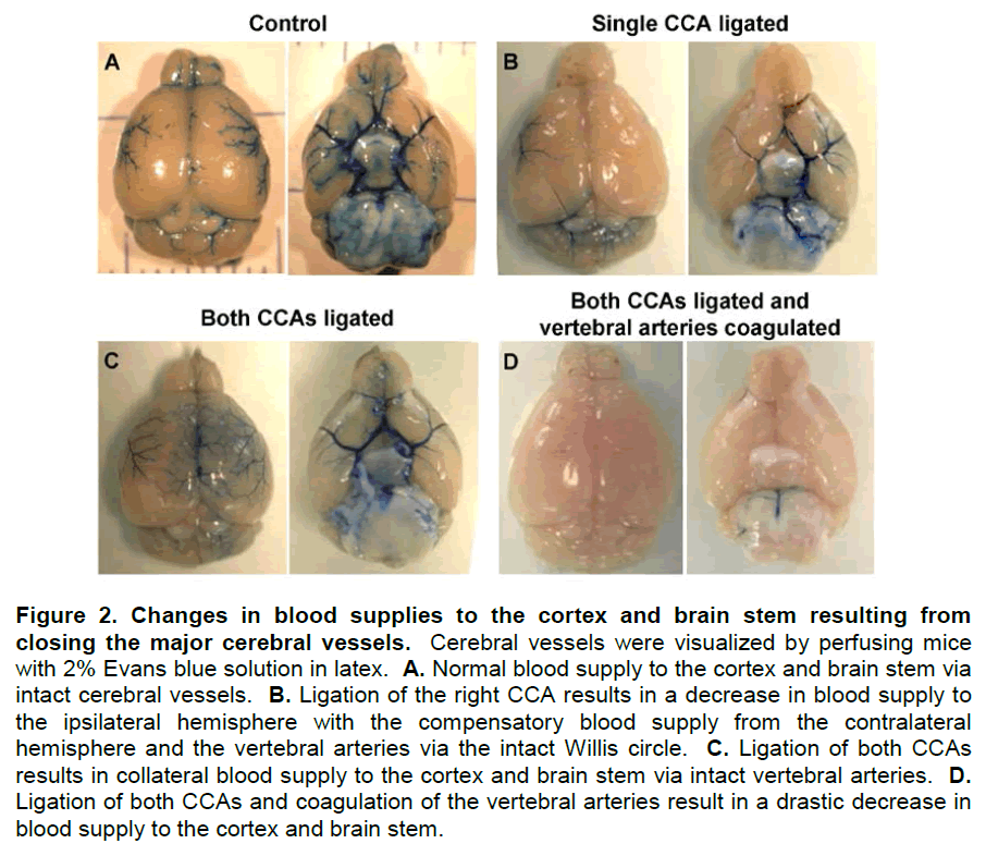 experimental-stroke-translational-medicine-blood-supplies