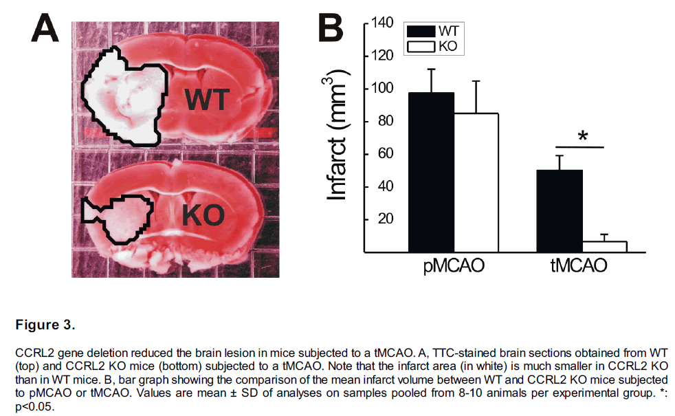 experimental-stroke-translational-medicine-brain-sections