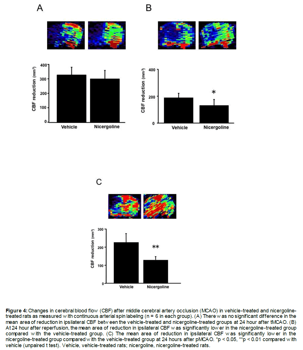 experimental-stroke-translational-medicine-cerebral-blood-flow