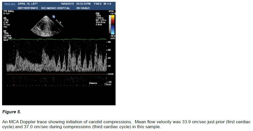 experimental-stroke-translational-medicine-flow-velocity