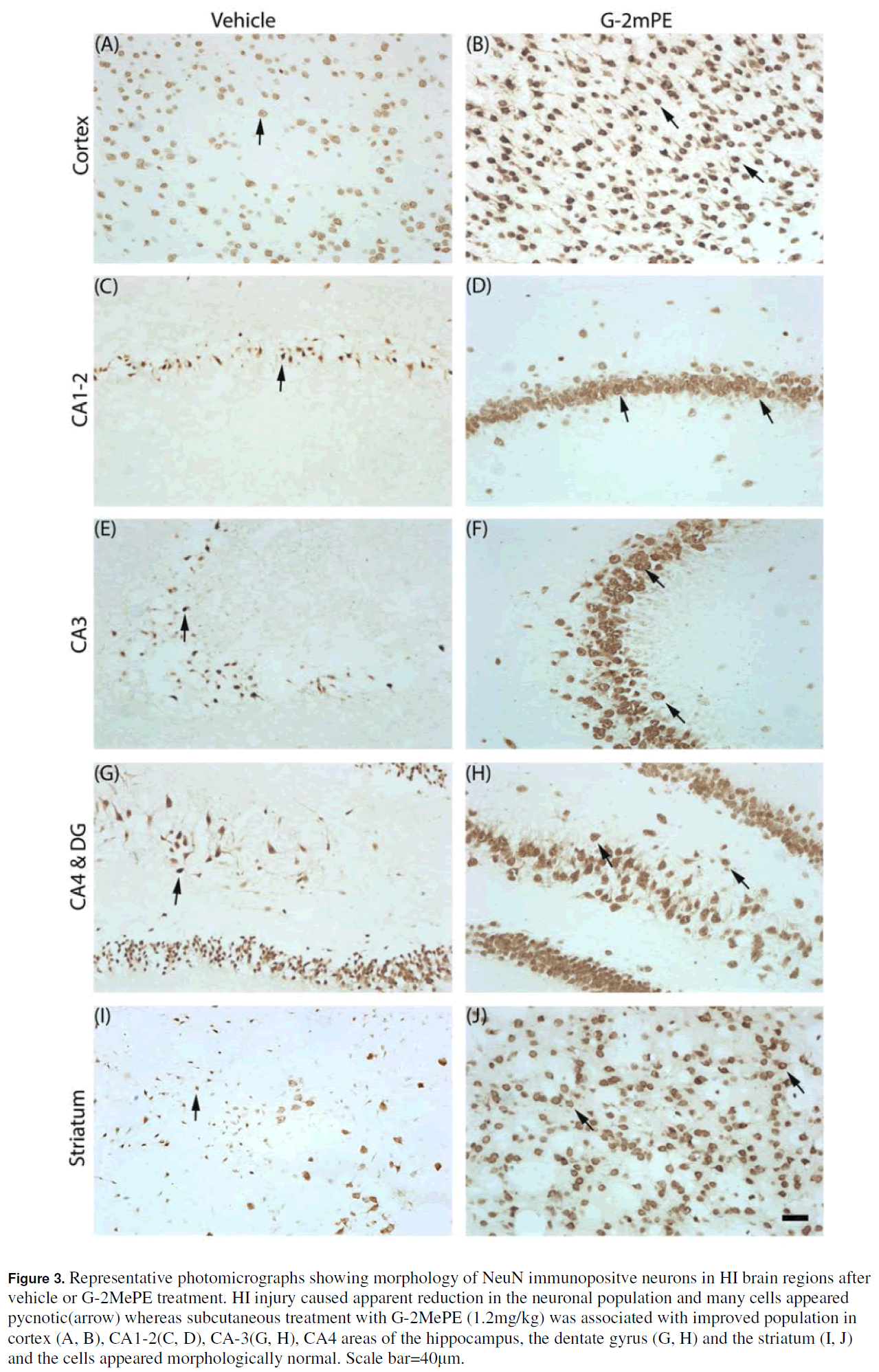 experimental-stroke-translational-medicine-immunopositve-neurons
