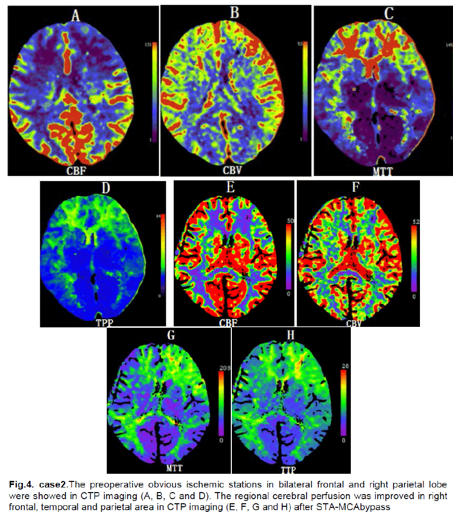 experimental-stroke-translational-medicine-ischemic-stations