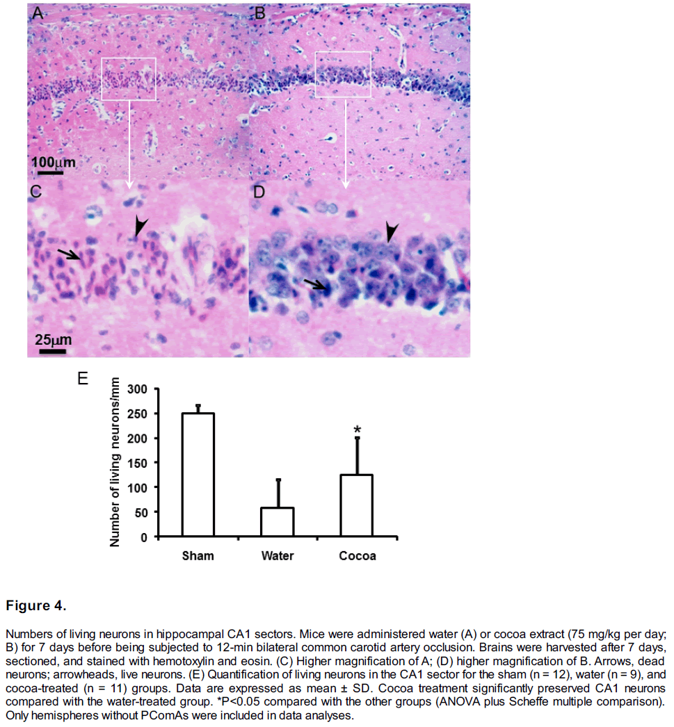 experimental-stroke-translational-medicine-living-neurons