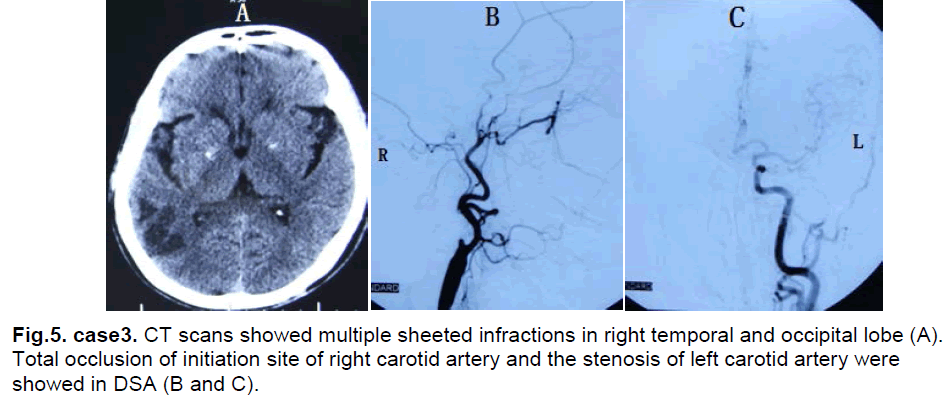 experimental-stroke-translational-medicine-multiple-sheeted