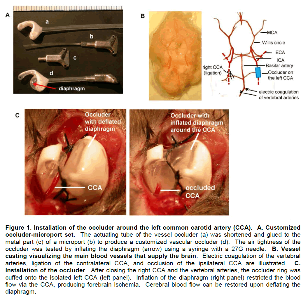 experimental-stroke-translational-medicine-occluder-around