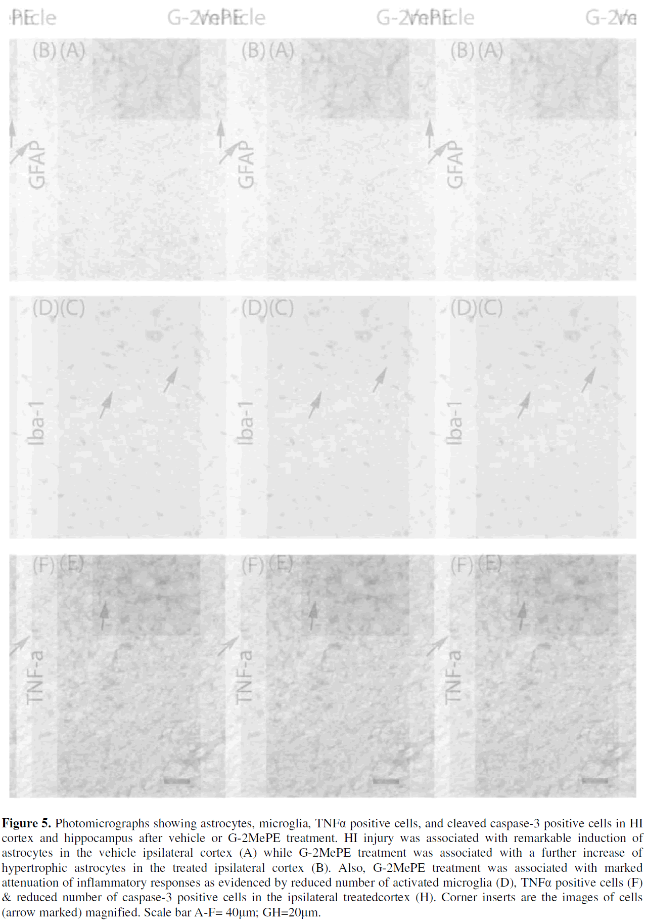 experimental-stroke-translational-medicine-positive-cells