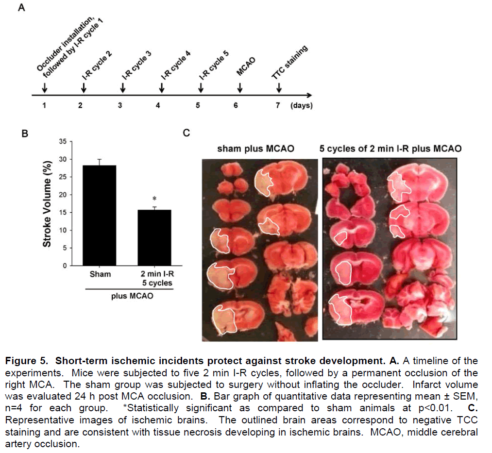 experimental-stroke-translational-medicine-stroke-development