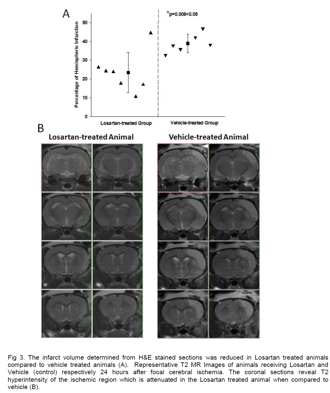 experimental-stroke-vehicle-treated