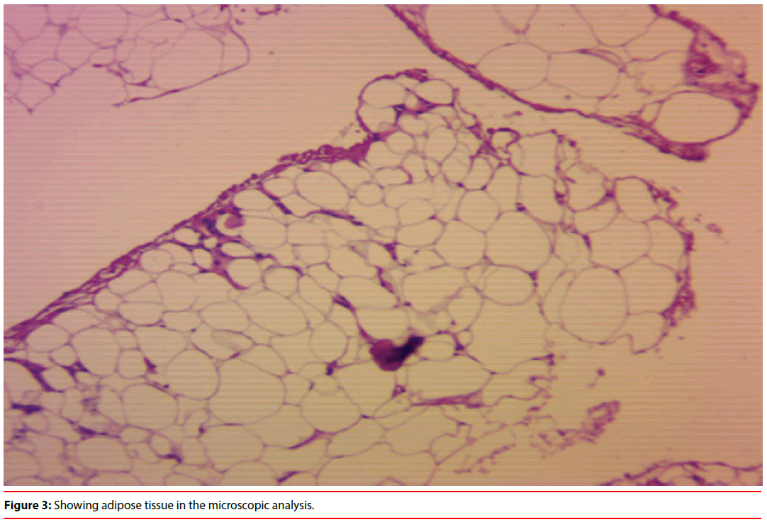 ijocs-adipose-tissue