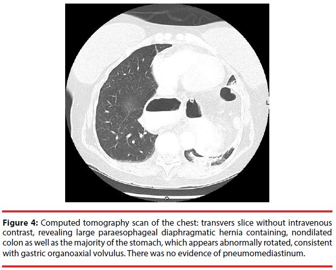 ijocs-gastric-organoaxial