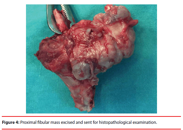 ijocs-histopathological