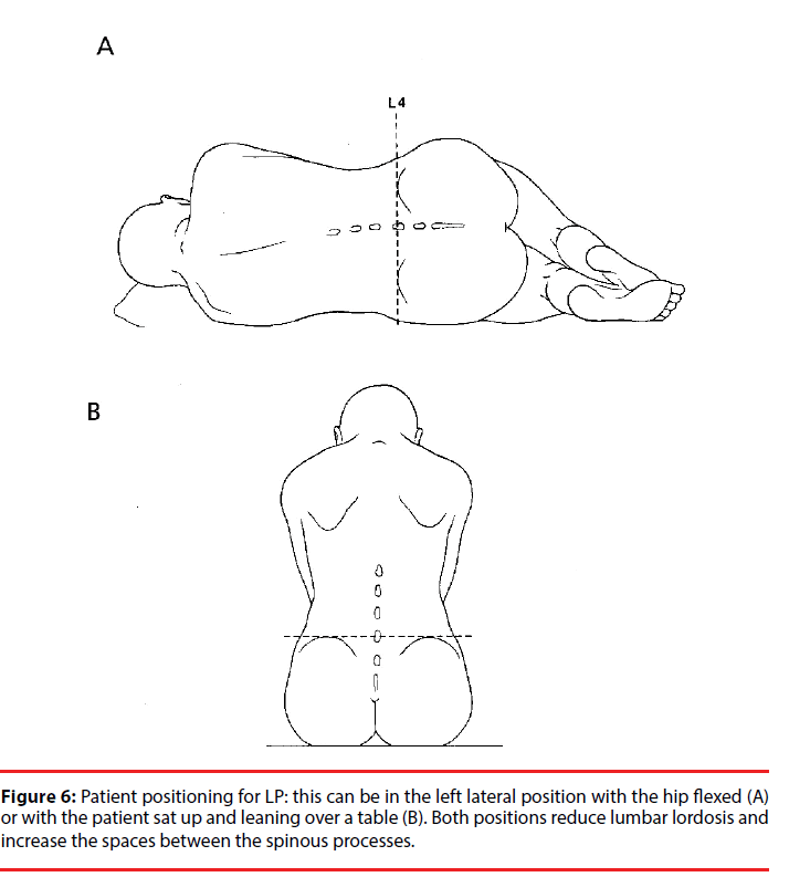 ijocs-positions-lumbar