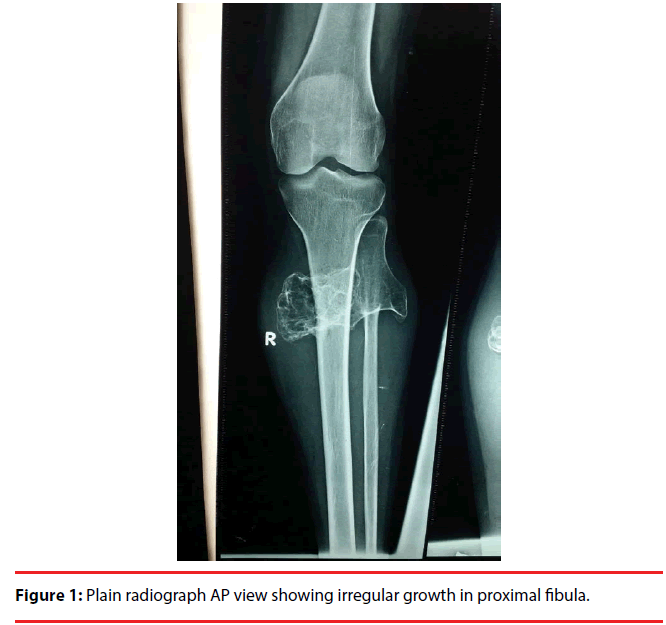 ijocs-radiograph-growth
