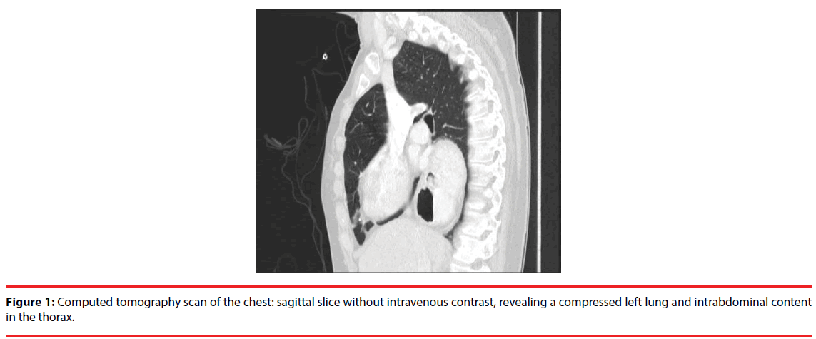 ijocs-sagittal-slice-lung