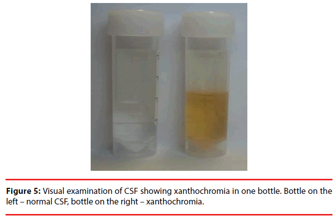 ijocs-spinal-bottle-right