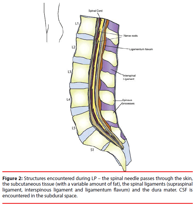 ijocs-spinal-ligaments