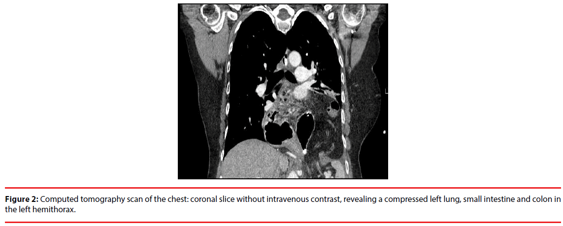 ijocs-tomography-scan-chest