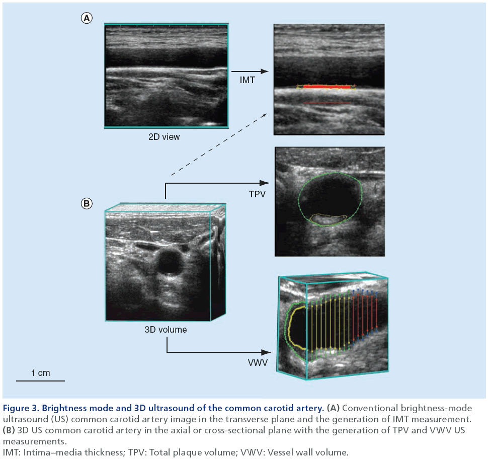 imaging-in-medicine-3D-ultrasound