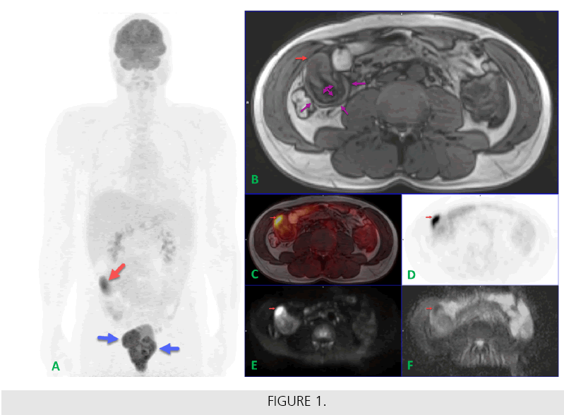 imaging-in-medicine