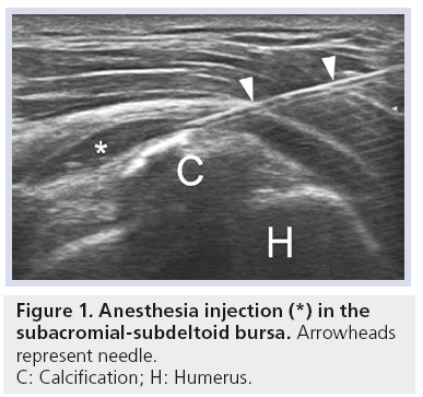 imaging-in-medicine-Anesthesia-injection