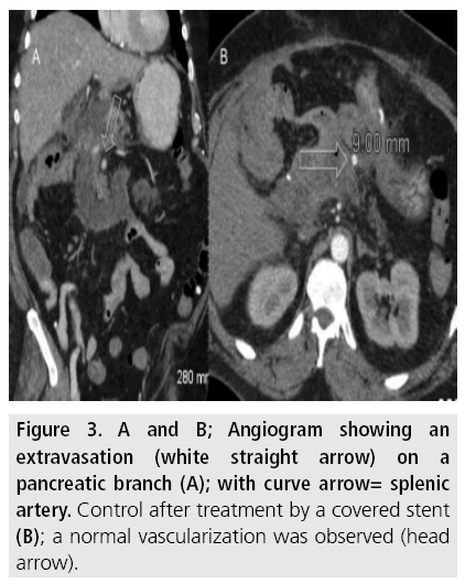 imaging-in-medicine-Angiogram