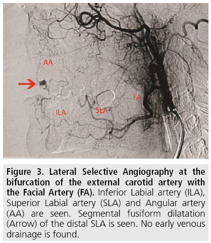 imaging-in-medicine-Angiography