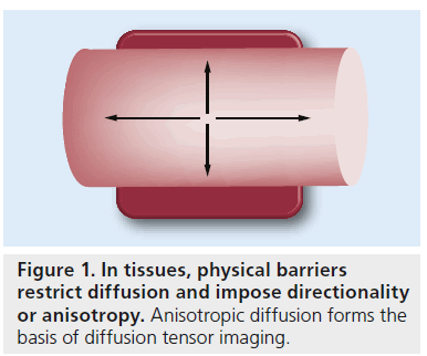 imaging-in-medicine-Anisotropic-diffusion