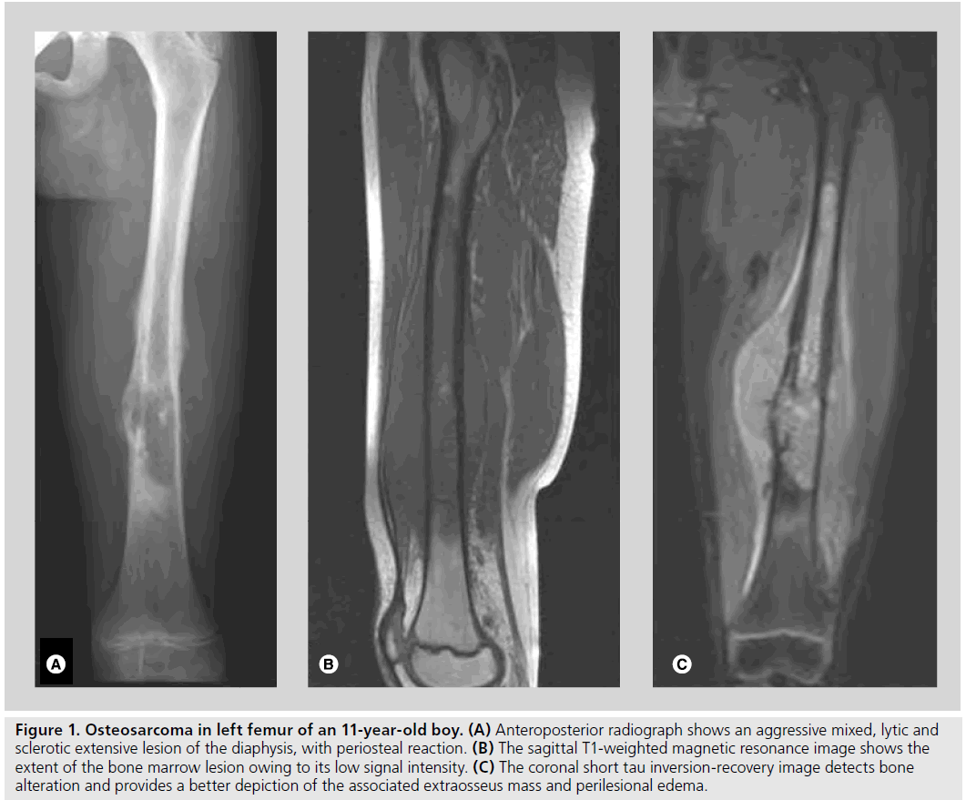 imaging-in-medicine-Anteroposterior-radiograph