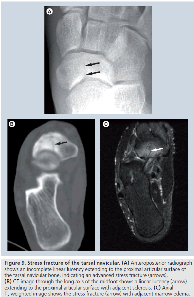 imaging-in-medicine-Anteroposterior-radiograph