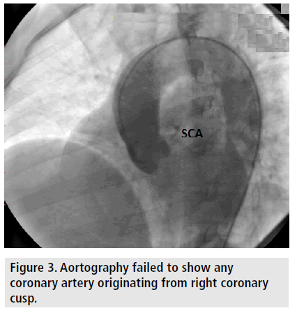 imaging-in-medicine-Aortography-failed