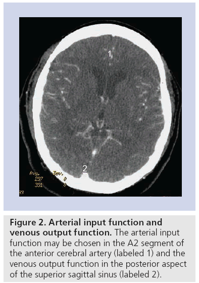 imaging-in-medicine-Arterial-input