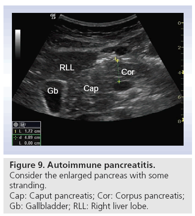 pancreas ultrasound