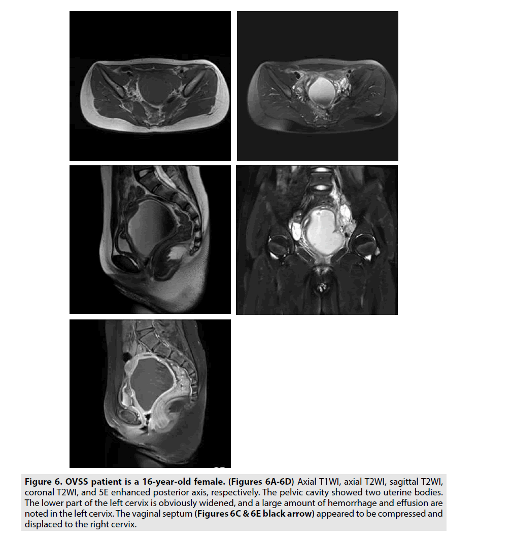 imaging-in-medicine-Axial-T1WI