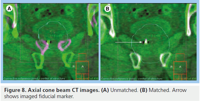 imaging-in-medicine-Axial-cone