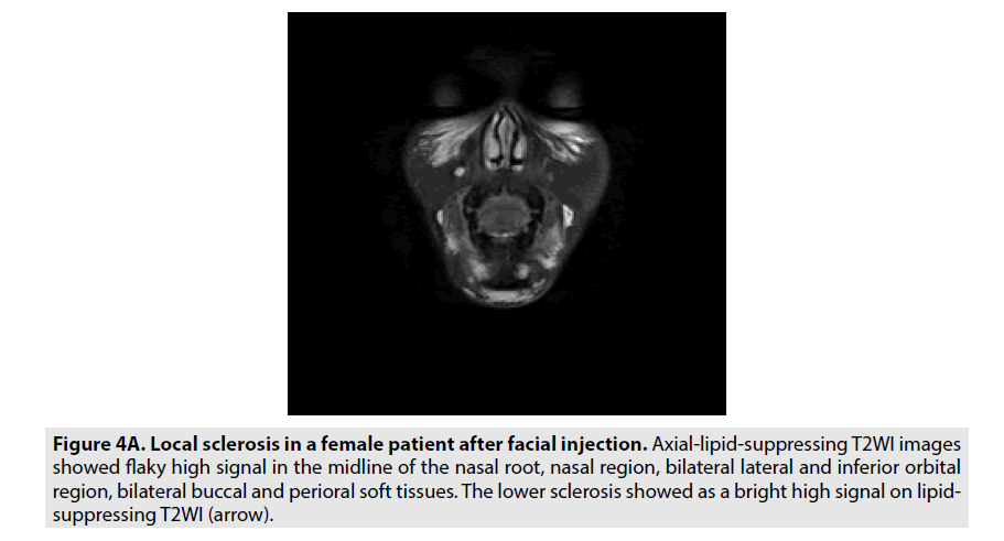 imaging-in-medicine-Axial-lipid