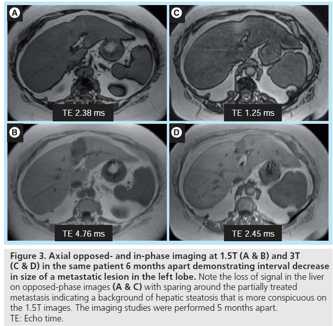 imaging-in-medicine-Axial-opposed