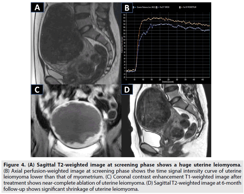 imaging-in-medicine-Axial-perfusion