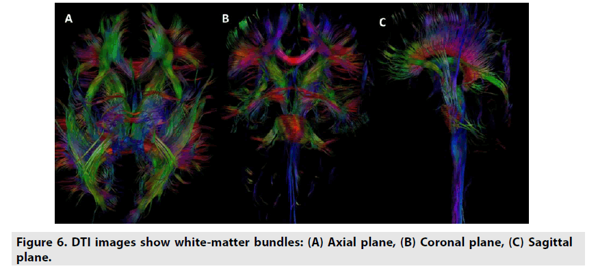 imaging-in-medicine-Axial-plane
