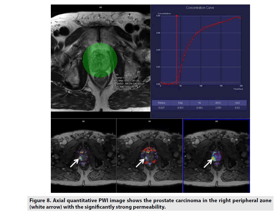 imaging-in-medicine-Axial-quantitative