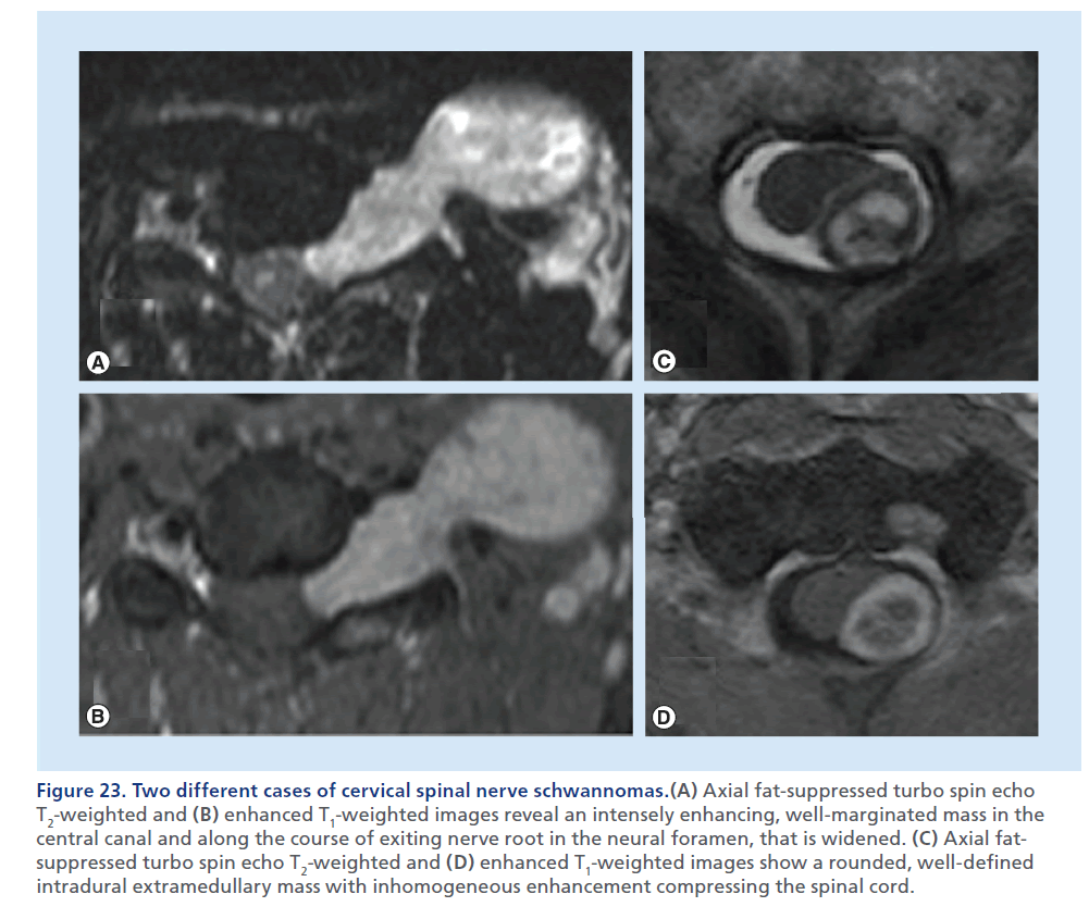 imaging-in-medicine-Axial–fat
