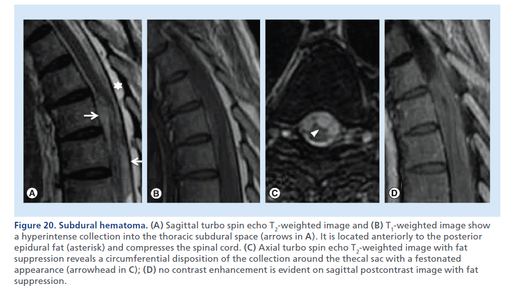 imaging-in-medicine-Axial–turbo