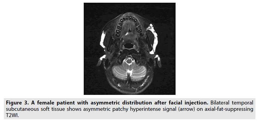 imaging-in-medicine-Bilateral-temporal