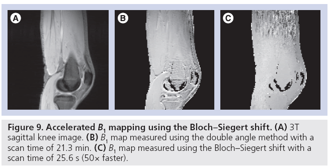 imaging-in-medicine-Bloch–Siegert