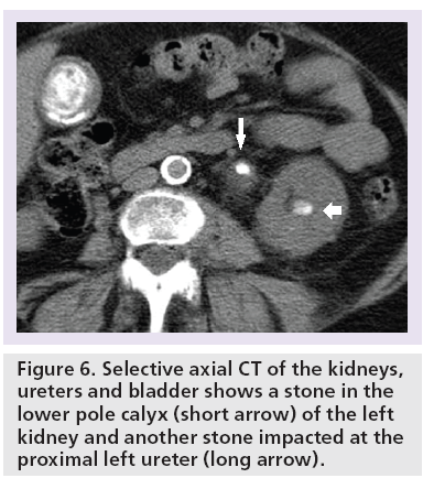 imaging-in-medicine-CT