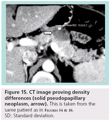 imaging-in-medicine-CT-image